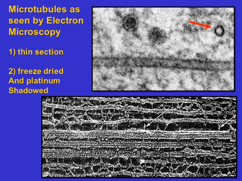 Microtubules as seen by Electron Microscopy  1) thin section  2) freeze dried